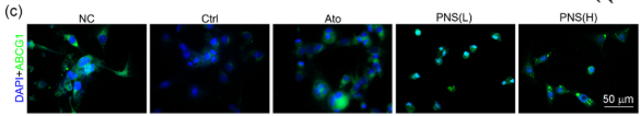 ABCA1 Antibody - FIGURE 2 Panax notoginseng saponins (PNS) reduces foam cell formation in atherosclerotic plaque and peritoneal macrophages.