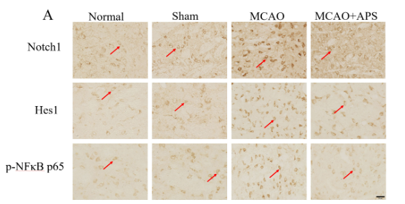 HES1 Antibody - Fig.