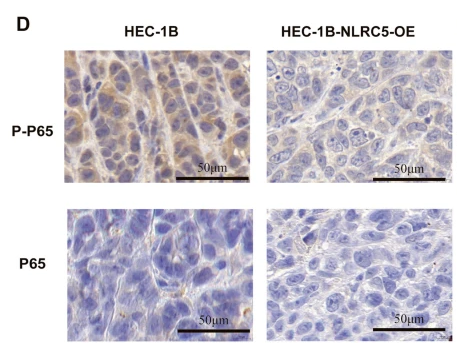Phospho-NF-kB p65 (Ser536) Antibody - Figure 4 NLRC5 suppresses the NF-κB pathway in vivo and in vitro.