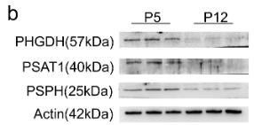 PSPH Antibody - Figure 2.