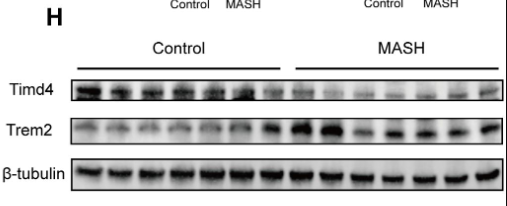 TIM 4 Antibody - Figure 9.