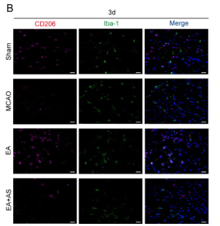 MRC1/CD206 Antibody - Fig.