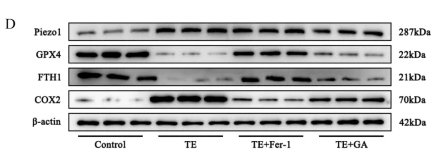 FTH1 Antibody - Fig.