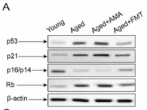 p21 Cip1 Antibody - Fig.