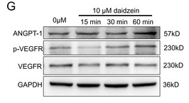 Angiopoietin 1 Antibody - Figure 3: Daidzein improves migration and proliferation of BMECs.