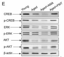 Phospho-CREB (Ser133) Antibody - Fig.