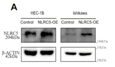 NLRC5 Antibody - Figure 1 NLRC5 promotes the migration and invasion of EC cells and enhances the proliferation of EC in vivo and in vitro.