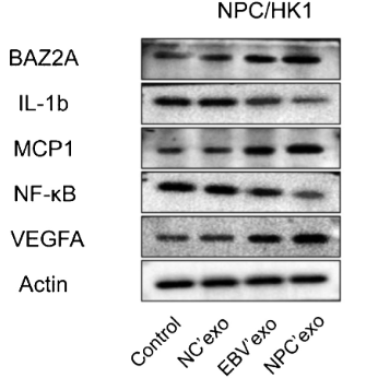 IL1 beta Antibody - Figure 4 The expression level of BAZ2A, IL-1β, MCP1, NF-κB, and VEGFA in NPC cells treated by different exosomes was detected by the Western blotting assay.