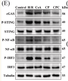 Phospho-NF-kB p65 (Ser536) Antibody - Fig.