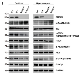 Phospho-PTEN (Ser380+Thr382+Thr383) Antibody - Figure 5 Smek1 deficiency enhances the development of tau pathology and interfere microtubule stability via PI3K/AKT pathway.