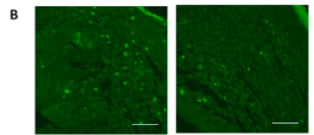 Oxytocin Receptor Antibody - Fig.