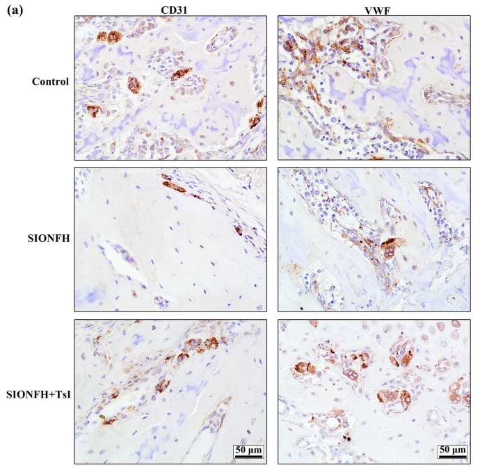 VWF Antibody - Fig.