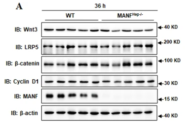 Phospho-LRP5 (Tyr1473) Antibody - Fig.