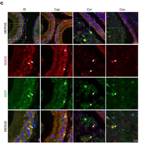 GGCX Antibody - Figure 1.