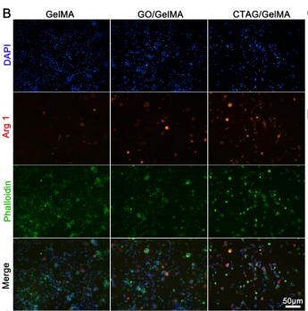 ARG1 Antibody - Fig.