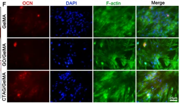 Osteocalcin Antibody - Fig.