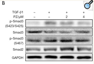 Smad3 Antibody - Figure 5.