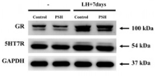 NR3C1 Antibody - Figure 2.