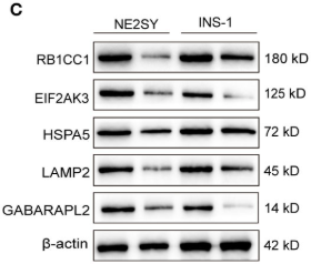 GRP78 Antibody - Figure 7 RT-qPCR and Western blot validation of the DEARGs in STZ-treated islet cells.