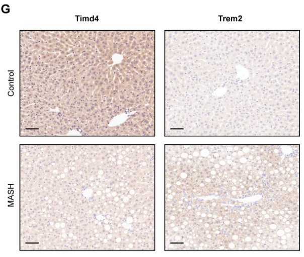 TIM 4 Antibody - Figure 9.