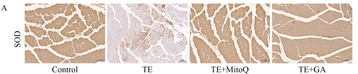 SOD1 Mouse Monoclonal Antibody - Fig.