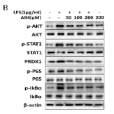 Phospho-STAT1 (Tyr701) Antibody - Figure 6.