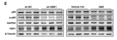 Phospho-NF-kB p65 (Ser536) Antibody - Figure 4.
