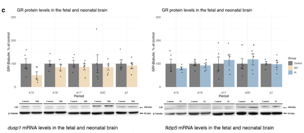NR3C1 Antibody - Figure 4.