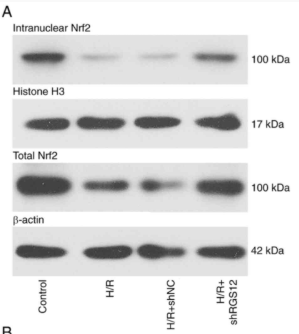 Nrf2 Antibody - Figure 4 - RGS12 silencing activates the Nrf2 signaling pathway.