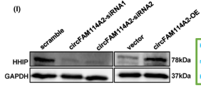 Hhip Antibody - FIGURE 5 CircFAM114A2 upregulates HHIP expression via “miR-630 sponge”.