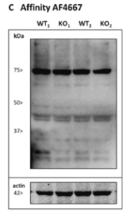Oxytocin Receptor Antibody - Fig.