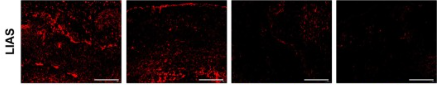 LIAS Antibody - Fig.