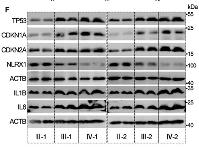 p21 Cip1 Antibody - Figure 1.