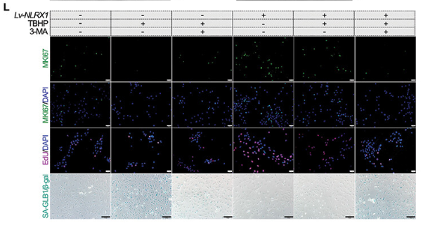 Ki67 Antibody - Figure 3.