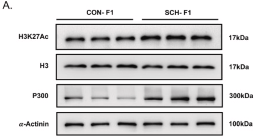 KAT3B/p300 Antibody - Fig.