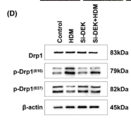 Phospho-DRP1 (Ser637) Antibody - FIGURE 5 Si-DEK alleviates apoptosis damage and mitochondrial fission in human nasal epithelial cells (HNEpCs).