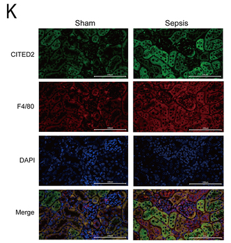 CITED2 Antibody - Figure 1 Impairment of kidney structure and function in septic mice, characterized by macrophage infiltration and elevated CITED2 expression.
