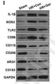 IL1 beta Antibody - Figure2 Germacrone attenuated the release of inflammatory factors and inhibits apoptosis.
