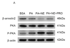 Phospho-PKA alpha  CAT (Ser339) Antibody - Fig.