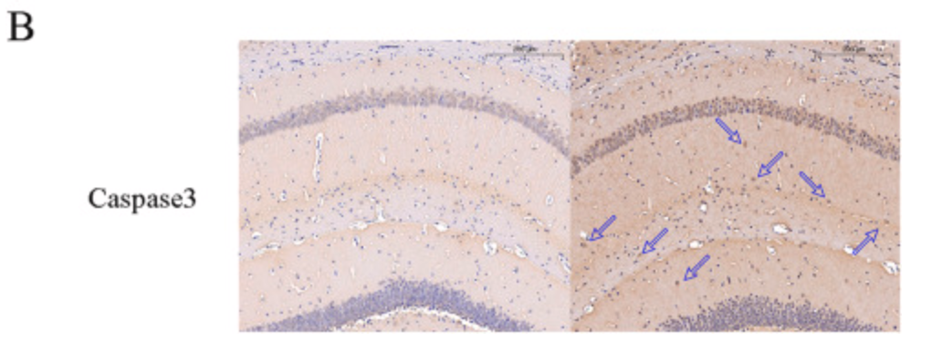 Cleaved-Caspase 3 (Asp175), p17 Antibody - Fig.
