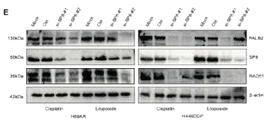 RAD51 Antibody - Figure3.