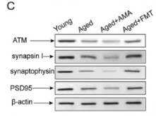 ATM Antibody - Fig.