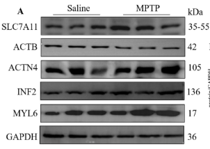ACTN4 Antibody - Figure 4.