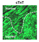 TNNT2 Antibody - Fig.