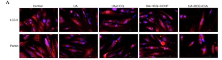 Parkin Antibody - Fig.