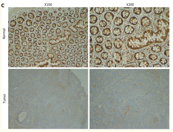 FABP4 Antibody - Figure 1.