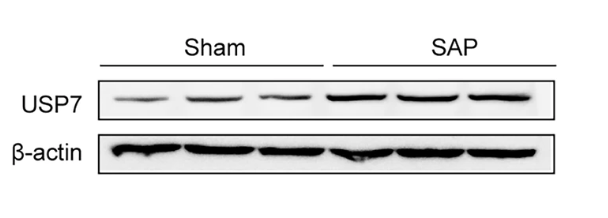 USP7 Antibody - Fig.