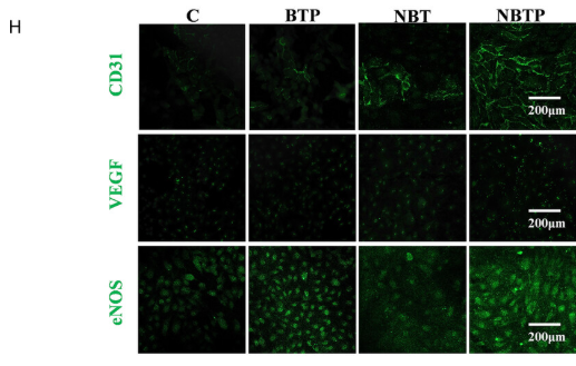 eNOS Antibody - Figure 7 NBT and NBTP surfaces promote HUVEC spreading, proliferation, and angiogenesis.