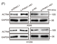 ACTN4 Antibody - FIGURE 3 Phosphorylase kinase regulatory subunit alpha 1 antisense RNA 1 (PHKA1-AS1) was found to localize in the cytoplasm and interact with actinin alpha 4 (ACTN4).