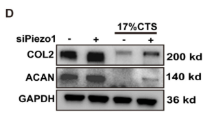 Aggrecan Antibody - FIGURE 3 Reducing Piezo1 expression partially alleviates the reduction of COL2 and ACAN caused by excessive mechanical stress.